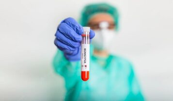 Testes para varíola dos macacos devem chegar no início de setembro Testes para varíola dos macacos devem chegar no início de setembro