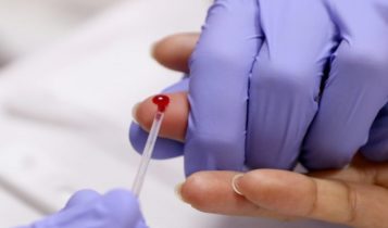 Saúde alerta sobre a prevenção contra HIV/Aids no Dezembro Vermelho