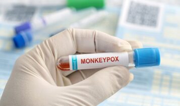 Sergipe confirma 13 novos casos de Monkeypox