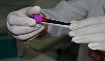 Hemose realiza cadastro de medula óssea neste sábado, 4