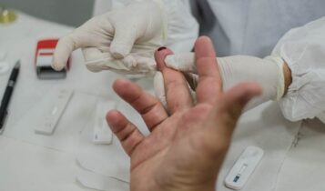 Testes de HIV e hepatites serão realizados no Mercado Thales Ferraz