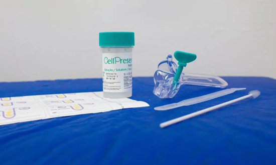 SUS inicia teste DNA-HPV para rastreamento do câncer de colo do útero SUS inicia teste DNA-HPV para rastreamento do câncer de colo do útero