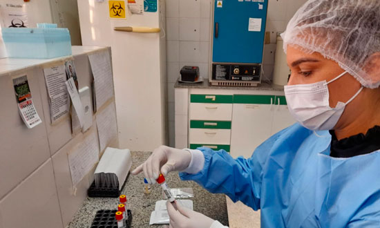Lacen realiza diagnósticos de Leishmaniose para controle em Sergipe Lacen realiza diagnósticos de Leishmaniose para controle em Sergipe